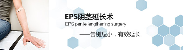 EPSӳ